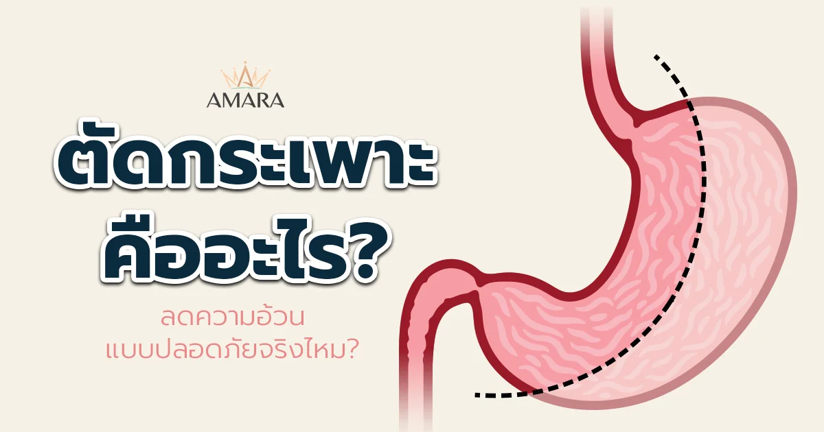 bariatric-surgery