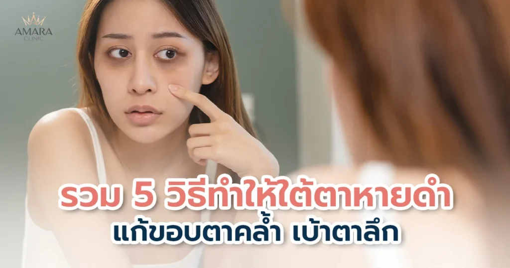 รวม 5 วิธีทำให้ใต้ตาหายดำ เปลี่ยนหน้าโทรมให้ดูสดใสและอ่อนเยาว์