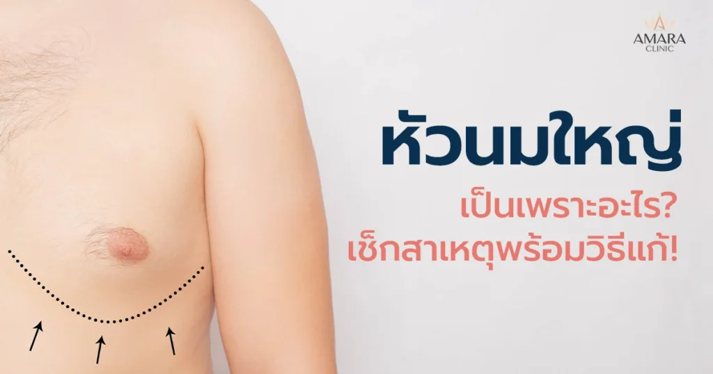 หัวนมใหญ่เกิดจากอะไร