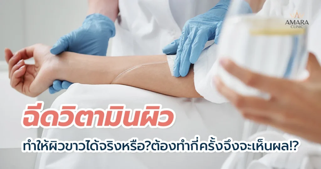 ดริปวิตามิน (IV Drip) คืออะไร