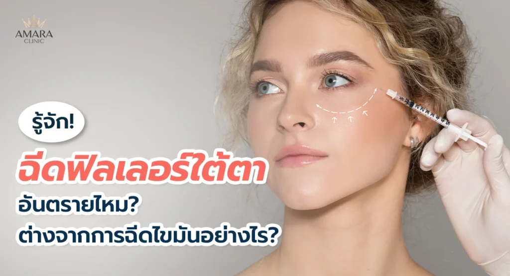 ฉีดฟิลเลอร์ใต้ตาคืออะไร อันตรายไหม แตกต่างจากฉีดไขมันหน้าเด็กอย่างไร