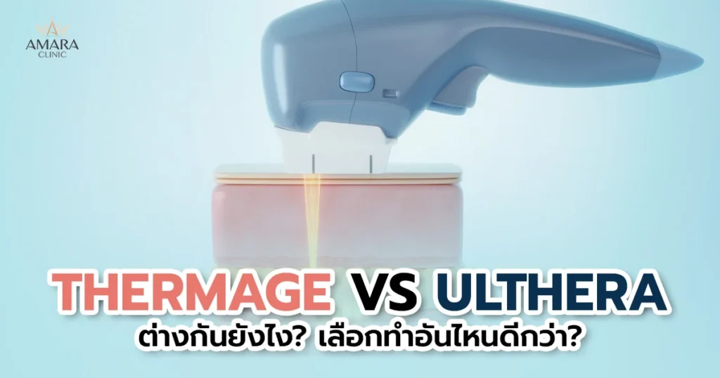 Thermage VS Ulthera