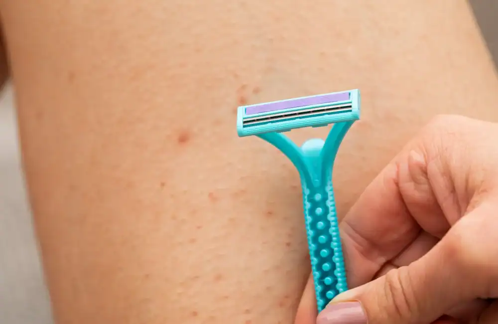 รูขุมขนอักเสบ Folliculitis